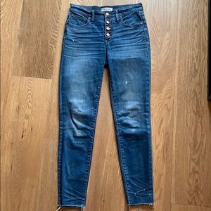 Madewell Button Front Jeans